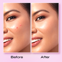 Recode Acne Patch Pack Of 36 Patches